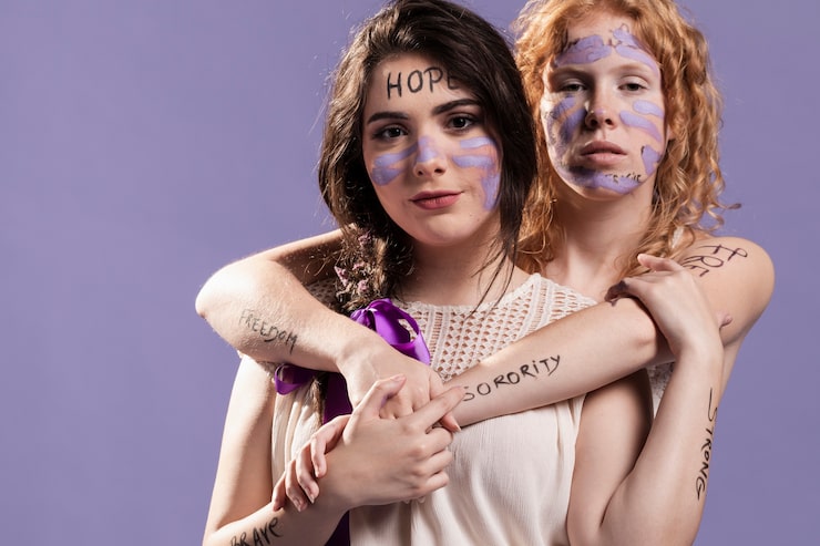 Embracing Uniqueness: The Rise of Vitiligo Models in the Lifestyle World
